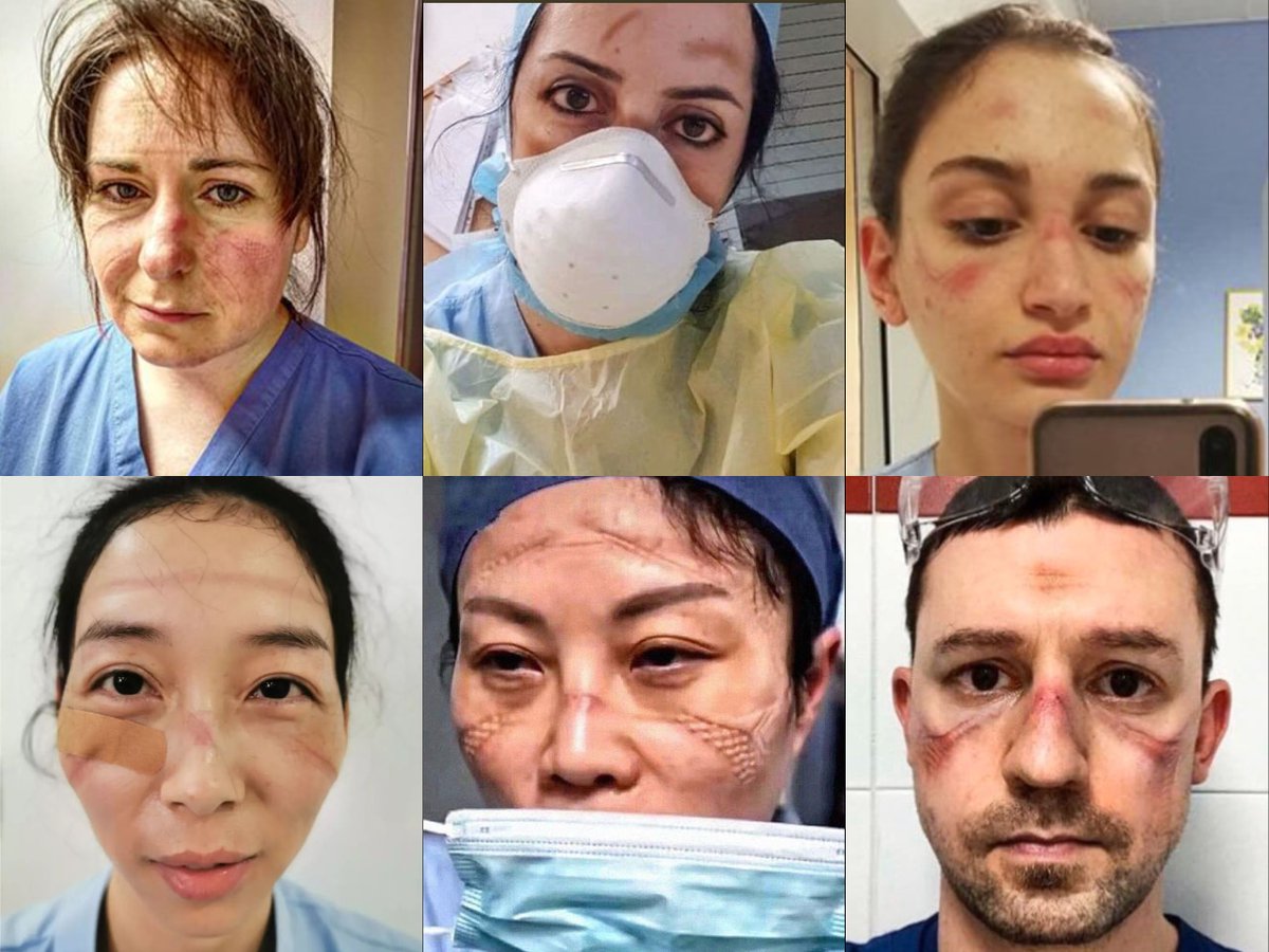 Indian__doctor's tweet photo. When the whole world was hiding in the houses with fear! 
Then in the scorching heat and humidity,the doctors put their lives at stake to save everyone,even without caring for their own lives!And today some leaders are asking doctors for a certificate of honesty?
#NoToRTH #Covid https://t.co/HhWrhV4Yr6