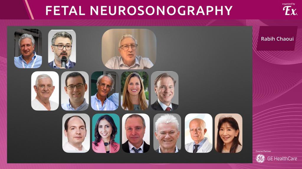 Asma Khalil on Twitter "What a fantastic Fetal Neurosonography course