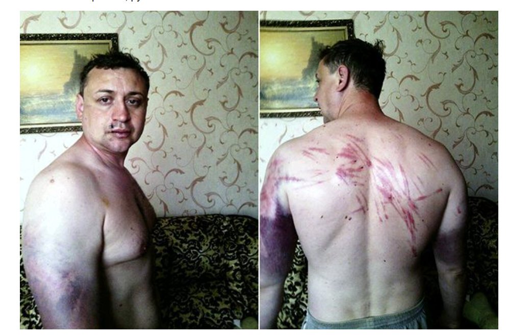 Май 2014г. Пастор протестантской церкви Сергей Косяк. Российские оккупанты пытали и избивали его лишь за то, что он организовал "Молитвы за Украину" в Донецке.
Позже российские оккупанты в ОРДЛО наделят "особым статусом" УПЦ МП и "выдавят" УПЦ КП, УГКЦ и протестантские церкви.