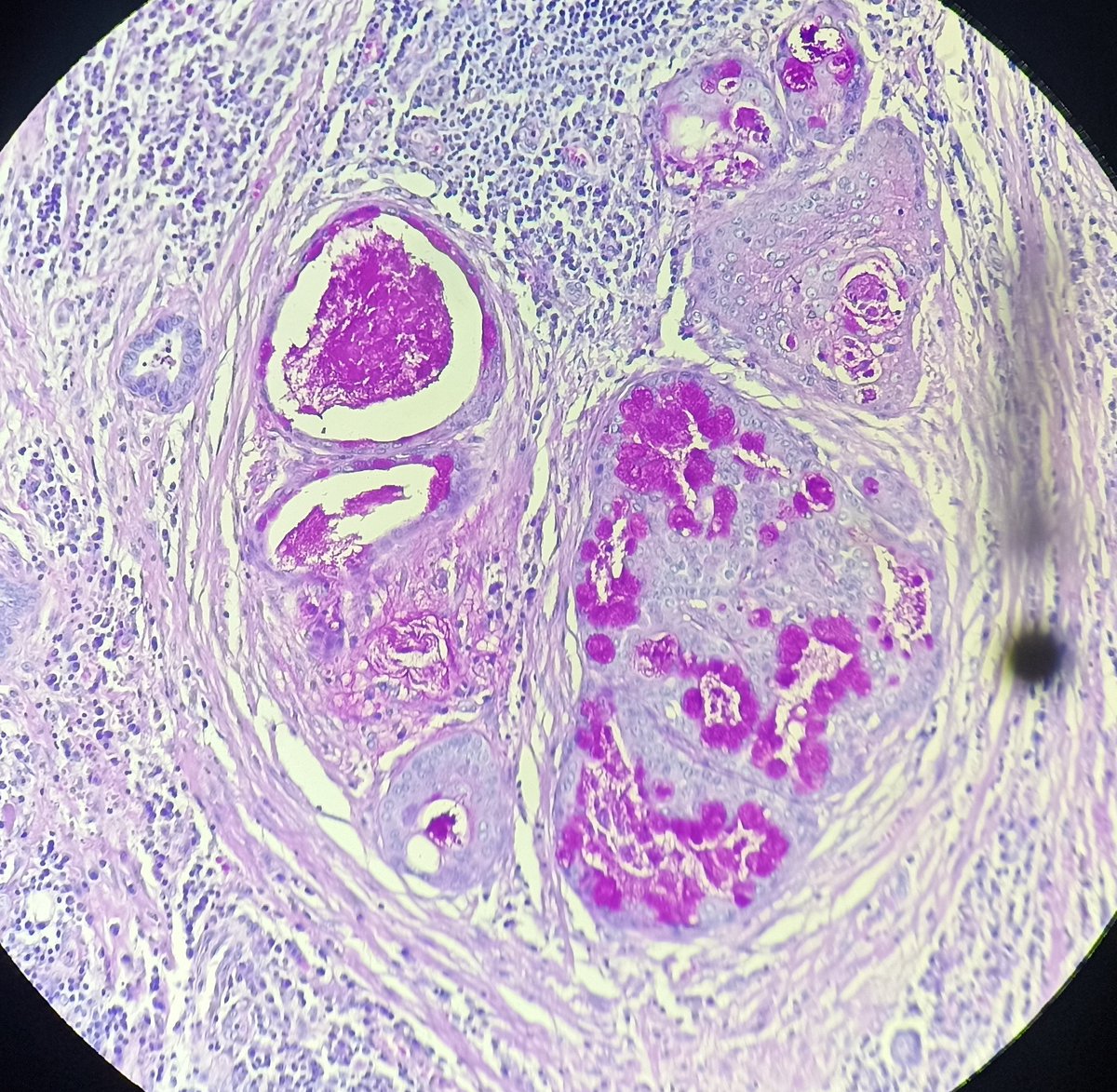 drdhanetwal's tweet image. PAS