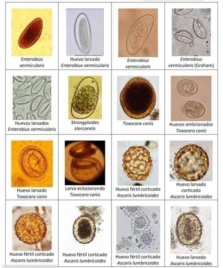 titamedtek's tweet image. Parasitology