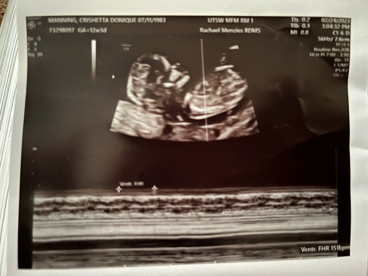 MetricDManning's tweet photo. “First comes love, then comes marriage… “ I’m sure you know the rest. #BabyManning ETA September 2023. Keep us in your prayers! 🙏🏽 #Blessed #NewBeginnings  #MakingRoomForMore #NoAprilFools #LoveOnTop https://t.co/F9EWyfdTxi
