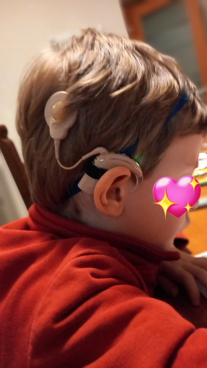 Killyger's tweet photo. Mio figlio giorno #4aprile dovrebbe subire un intervento per inserire il secondo #impiantococleare #IC e oggi si è svegliato influenzato dopo una settimana in casa🤣
Mi viene da urlare, si può essere così sfigati?😡
#BuonaDomenicadellePalme
#BuonaDomenica #sordità https://t.co/BEyGH2R3sN