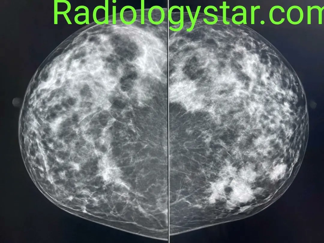 Star Examples Radiography Radiology Star (@radiologystar1) / Posts / X