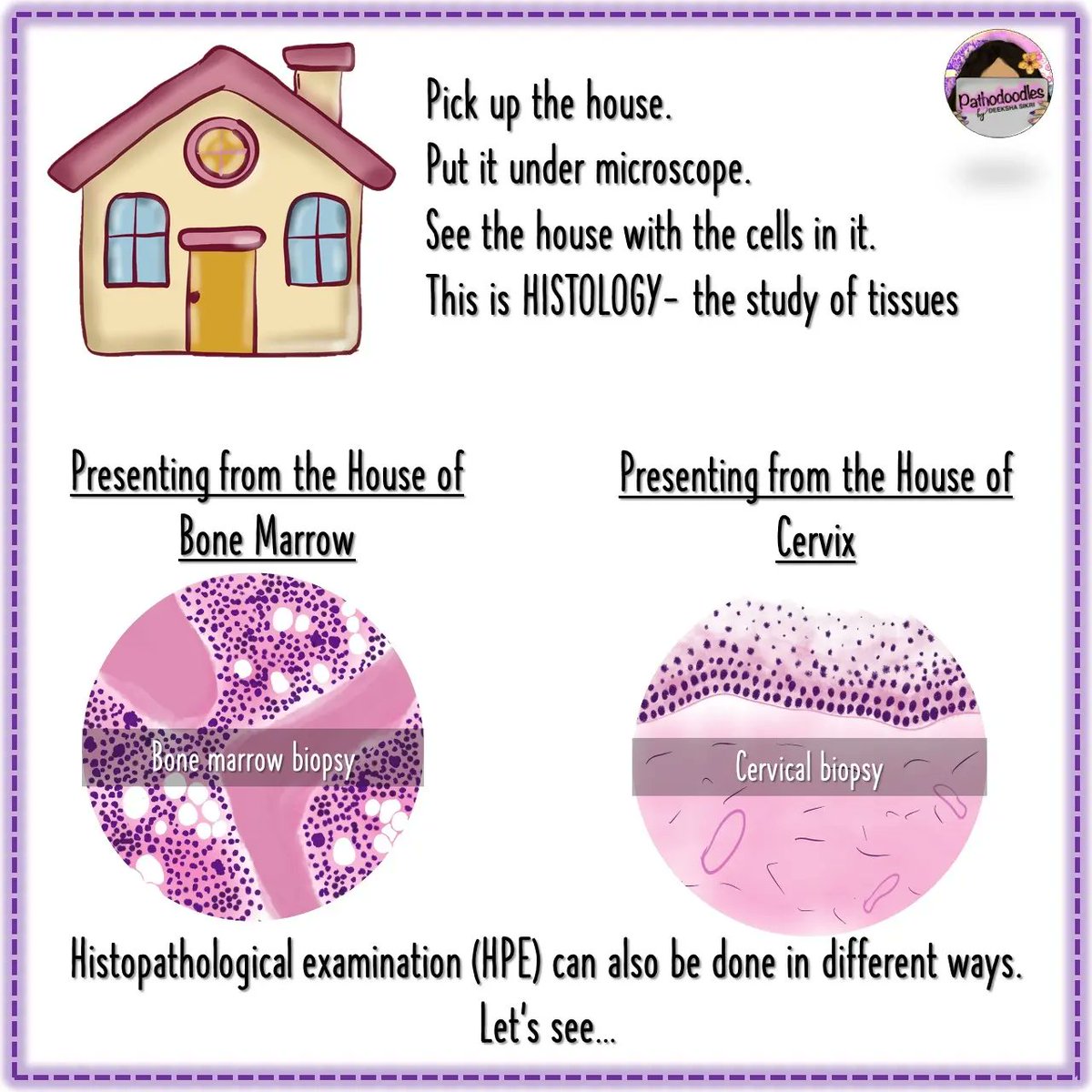 pathodoodles's tweet photo. A basic idea to differentiate between #histopath and #cytopath for #MedStudentTwitter and #PathTwitter 1/2 https://t.co/HZLfuEfPeo
