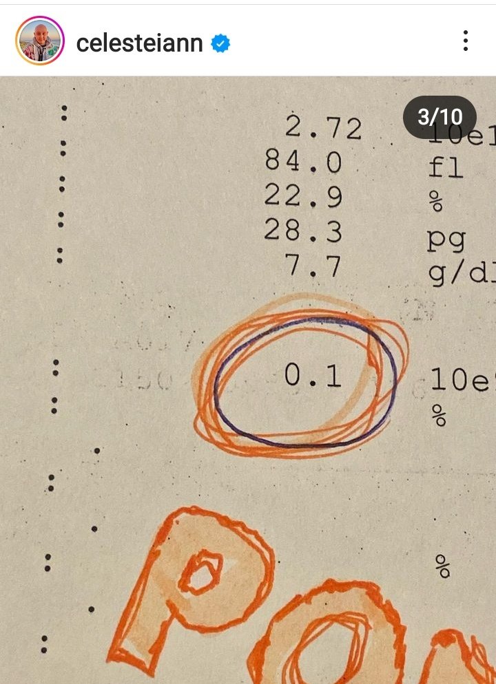 LauraSalz16's tweet image. #LoMasSimoleLoMasValioso 🍋🍊🍋🍊🍋🍊🍋

Por ej un jugo d pomelo cuando el tubo digestivo está lleno d llagas porq el transplante de médula demora en #prender 😪
Nos pidió una #Pomelada en espera.
Y así se hizo 💪💪
Eso no es novela 
🙏 es vida real q se puede acompañar en Ig