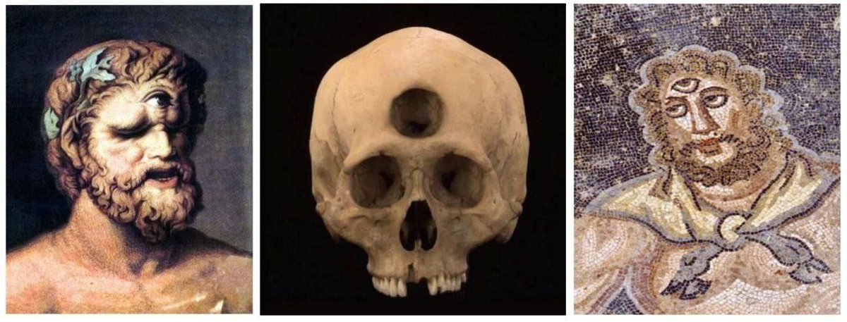 Cyclopes Skeleton Cyclops skull with three eye sockets found in Bulgaria In 1999 ...