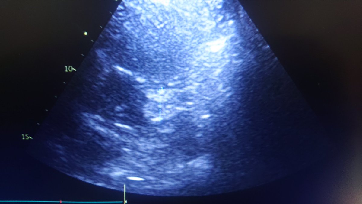 BenDhifallah Youssef tweet media