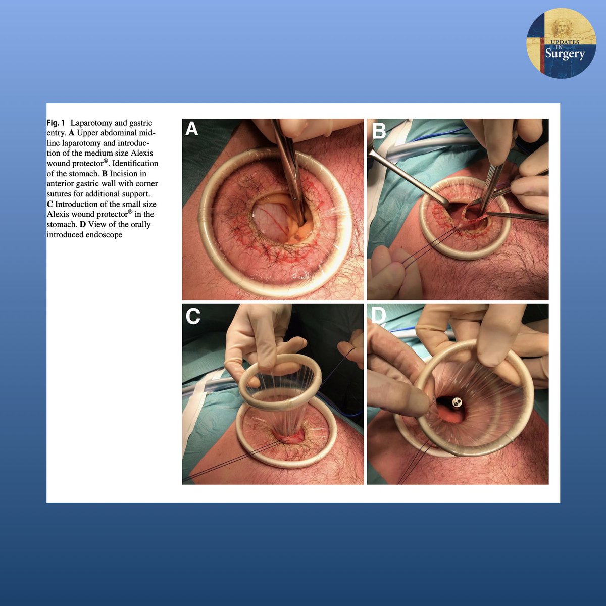Updates in Surgery tweet media