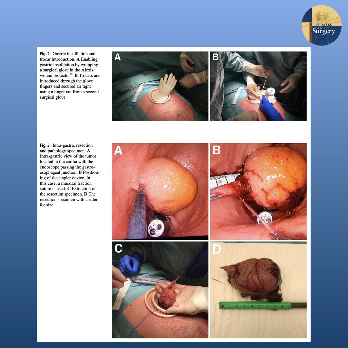 Updates in Surgery tweet media