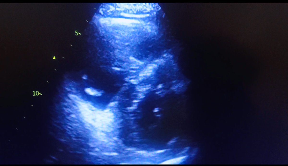 BenDhifallah Youssef tweet media