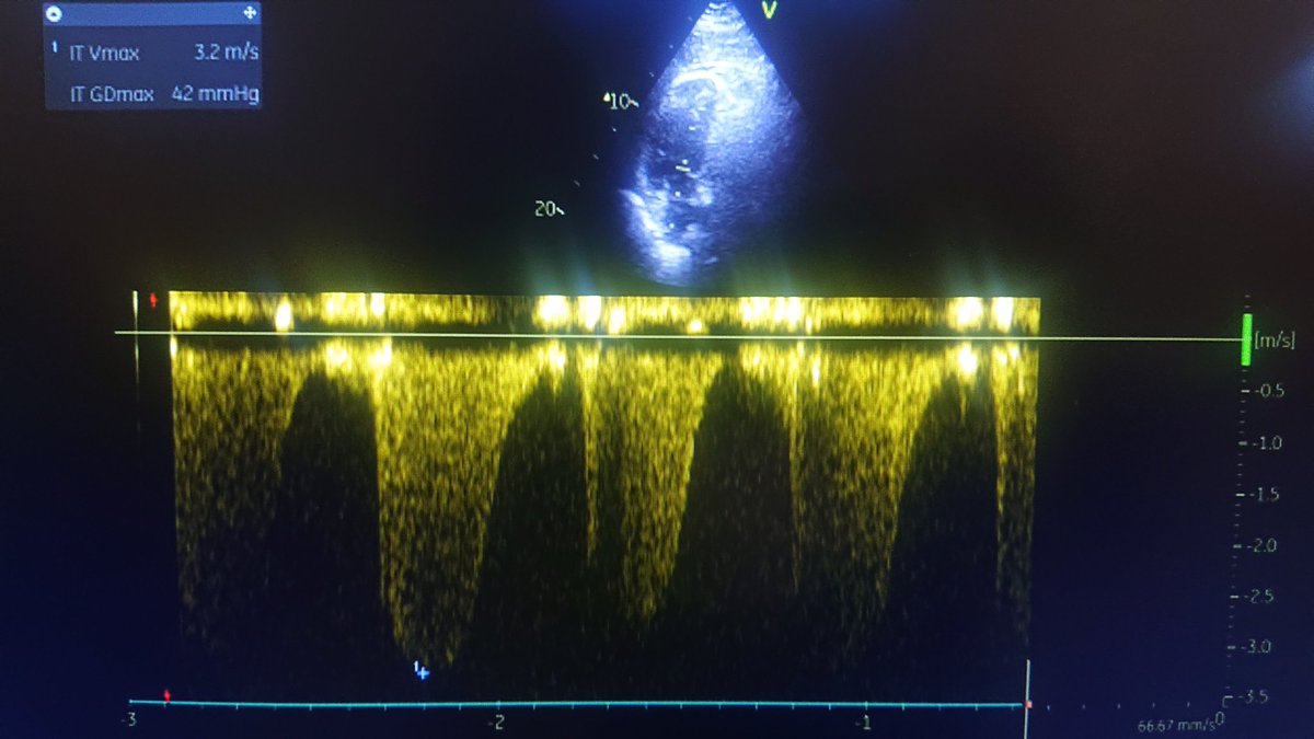 BenDhifallah Youssef tweet media