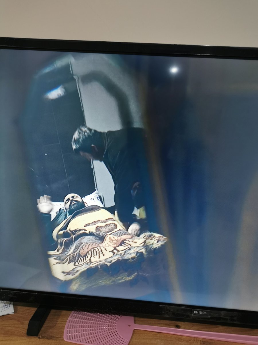 Bu şey değil mi ya 86 yaş hipernatremi + iye + pnömoni battaniyesi🤔