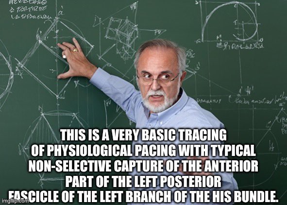 Nicolas Clementy (@clementy_ep) on Twitter photo 