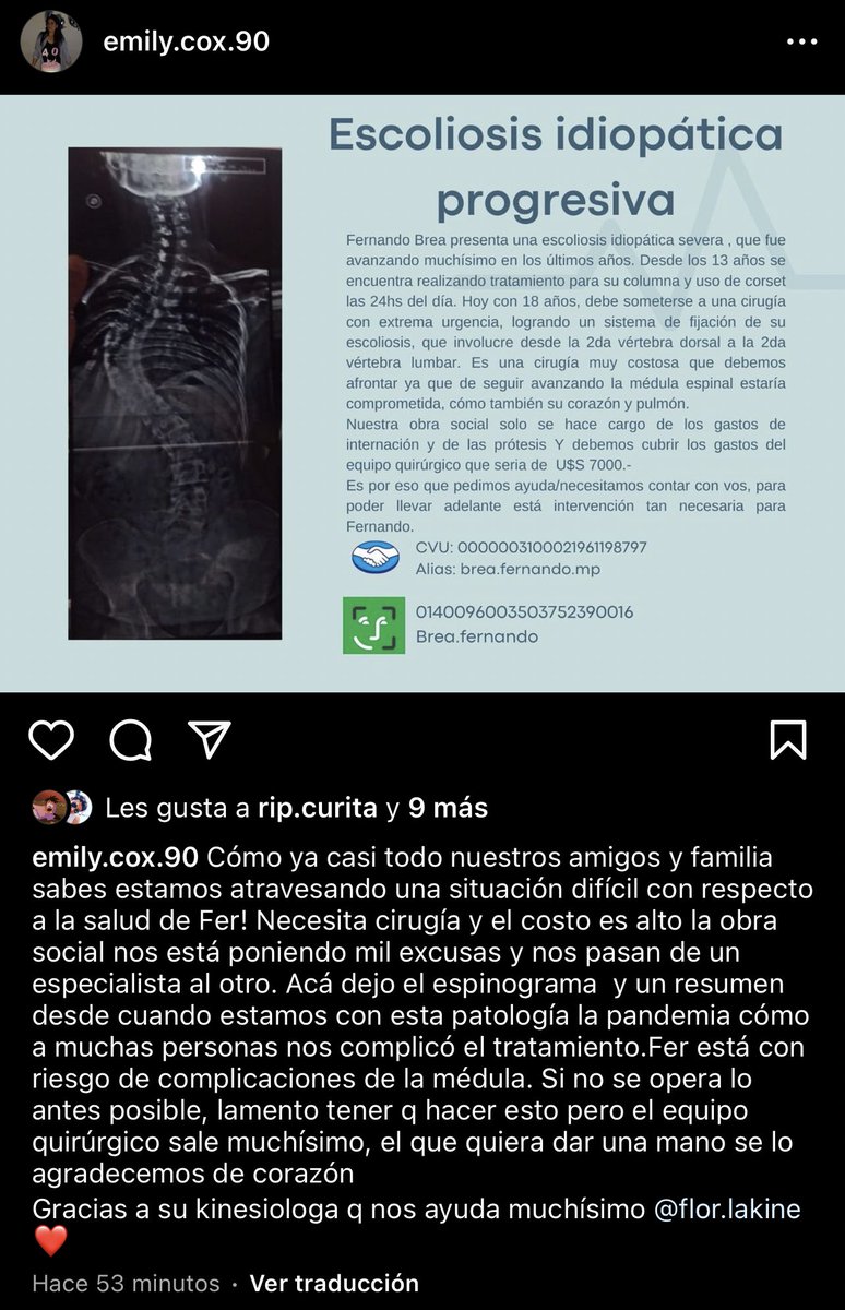 Nunca hago este tipo de tweets pero la situación lo amerita. Mi primo ferchu se tiene que someter a una operación de urgencia ya que tiene escoliosis ideopática progresiva. Los elementos quirúrgicos son demasiado costosos, estamos hablando de 7000dls👇🏽 RTS se agradecen.