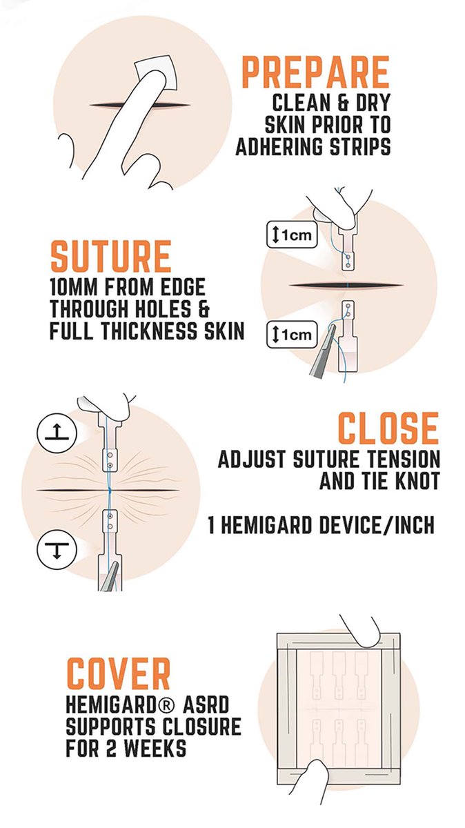 HEMIGARD ASRD in 4 simple steps #hemigardASRD
