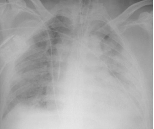 OperativeReview's tweet image. ARDS: The Advanced Review for Residents and Fellows

operativereview.com/acute-respirat…

#MedEd #SoMe4Surgery #ICU #ARDS