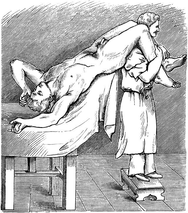 StoriaDellaMedicina (@storiamedicina) on Twitter photo The first description of #Trendelenburg's elevated position was given by one of his students, Willy Meyer in 1885.
Friedrich Trendelenburg described it in 1890, in his paper on vaginovesical fistula #surgery and has since taken its eponym.
#medizin <a href="/SurgeryLegends/">Legends Of Surgery</a> #chirurgia The first description of #Trendelenburg's elevated position was given by one of his students, Willy Meyer in 1885.
Friedrich Trendelenburg described it in 1890, in his paper on vaginovesical fistula #surgery and has since taken its eponym.
#medizin <a href="/SurgeryLegends/">Legends Of Surgery</a> #chirurgia
