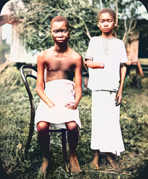 DaniMayakovski's tweet photo. Durante la ocupación del Congo del rey belga Leopoldo II como colonia personal, se estableció un esclavismo de 24 horas en las minas donde se explotaba hasta la muerte a los esclavos.

Si los congoleños (incluido niños) se negaban a trabajar hasta reventar para el monarca, les ataban a un arbol y les mutilaban las manos sin anestesia.

El genocida rey belga Leopoldo II exterminó a 10 millones de personas en solo 23 años, pasando el Congo de tener una población de 20 millones, a tener 10 millones.

Son masacres imperialistas de Occidente que no publicita a diario la "prensa libre" ni hablan de "trillones de muertos del capitalismo".