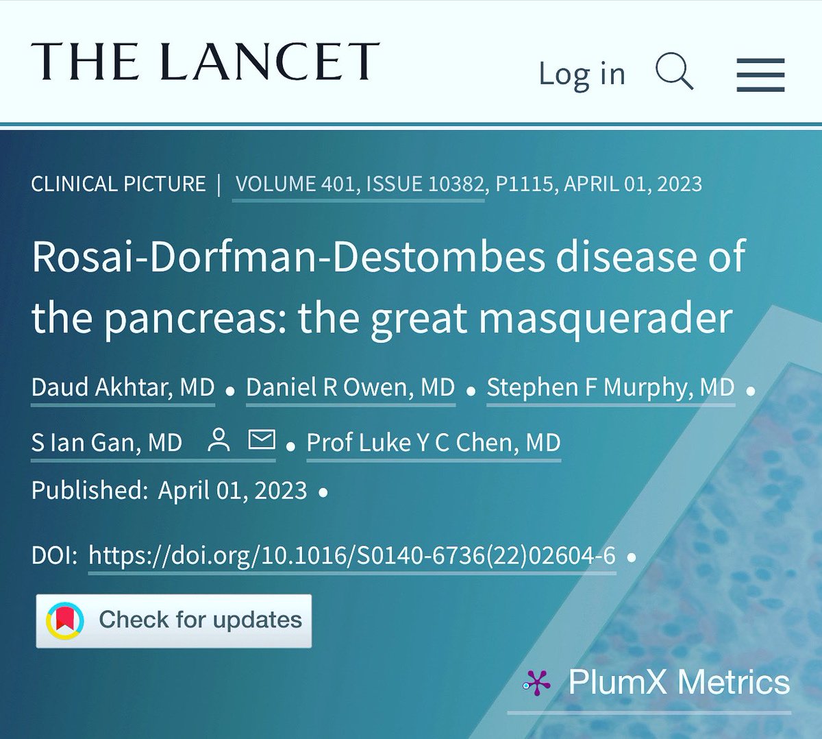 daudhakhtar's tweet photo. Fresh of the press! I think they liked my paper. I’m S-100% positive. #lancet #hematology #Gastroenterology #GITwitter #medicine #gi #research #worldshighestimpactfactorjournal https://t.co/MyeBlkKkwf
