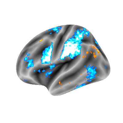 One contrast per day. characters suffering from mental pain versus physical pain. Task designed from @rebecca_saxe lab. All IBC contrasts available in search.kg.ebrains.eu and neurovault.org/collections/66…