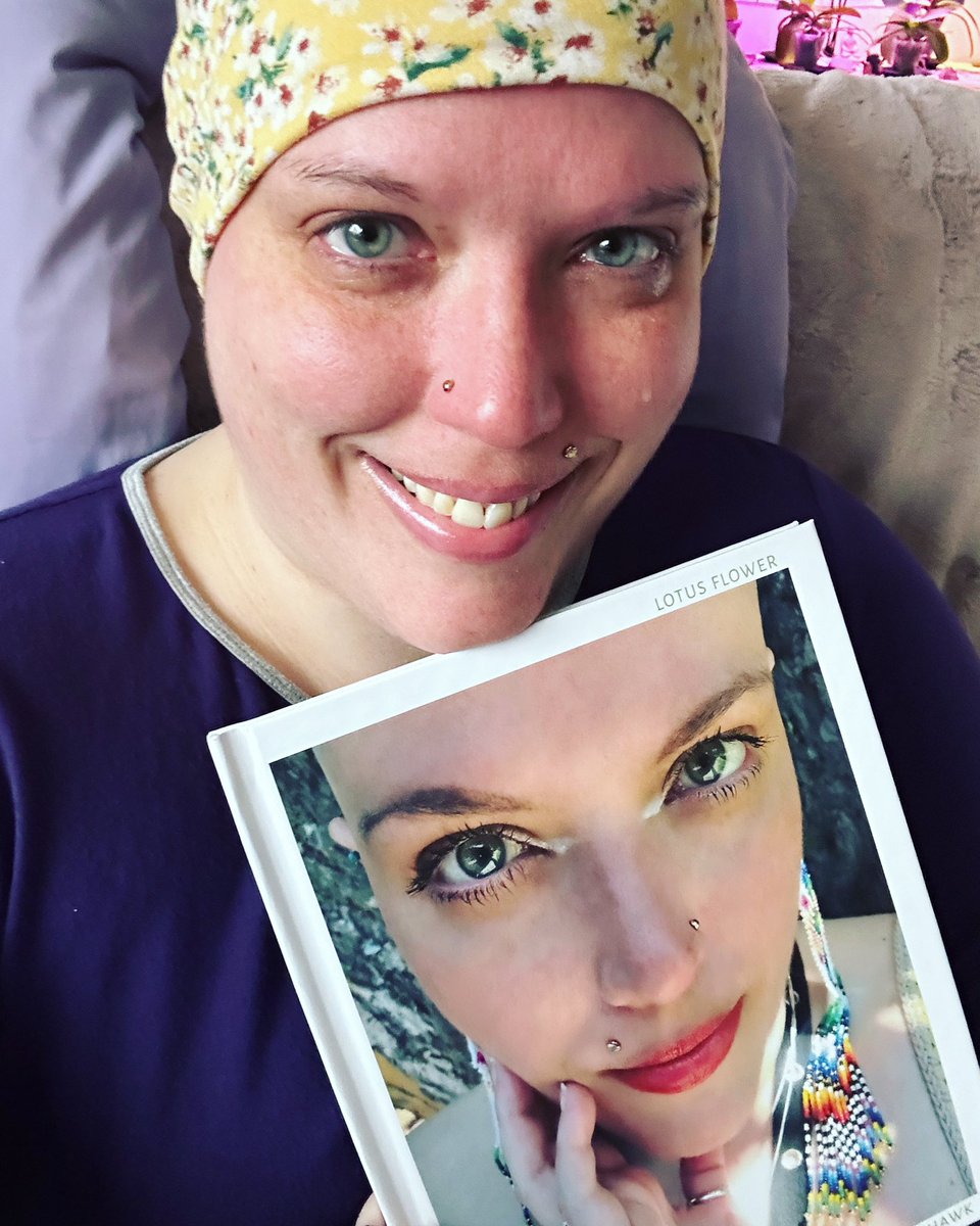 I will never forget the constellation of feelings I felt when I first held my book last week! ✨ 
More about my book coming soon. I’ve been in the hospital, and posting to social media hasn’t been possible. 🪷 

#photographer #Published #NewBook #HidradenitisSuppurativa