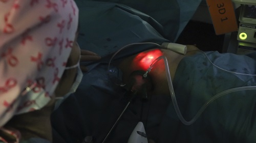 Hospital del Mar (@hospitaldelmar) on Twitter photo El <a href="/hospitaldelmar/">Hospital del Mar</a> es uno de los primeros centros catalanes que utiliza #endoscopia en #mastectomías
Se hace la intervención a través de una única incisión, reduciendo impacto estético y complicaciones después de #cirugía
bit.ly/Endoscopia_cir… <a href="/nuria_argudo/">Nuria Argudo</a> <a href="/MarVernetTomas/">Maria del Mar Vernet-Tomas</a> El <a href="/hospitaldelmar/">Hospital del Mar</a> es uno de los primeros centros catalanes que utiliza #endoscopia en #mastectomías
Se hace la intervención a través de una única incisión, reduciendo impacto estético y complicaciones después de #cirugía
bit.ly/Endoscopia_cir… <a href="/nuria_argudo/">Nuria Argudo</a> <a href="/MarVernetTomas/">Maria del Mar Vernet-Tomas</a>