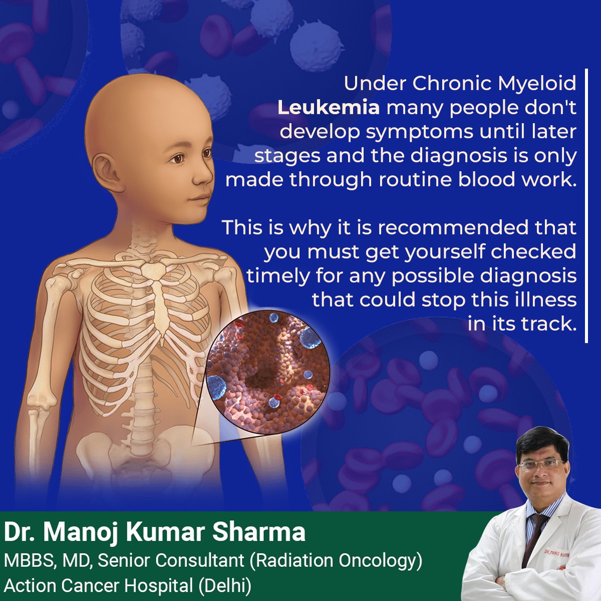 Chronic Myeloid Leukemia (CML) is a type of cancer that affects the blood and bone marrow. It is often asymptomatic in its early stages.
.
#ChronicMyeloidLeukemia #DrManoj #Treatmnent #Care #Oncologyst #Cancer #CancerCare #Cancersymptoms
