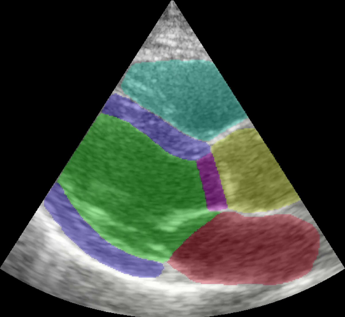 New position as researcher/programmer available at our research group in Trondheim sintef.no/en/sintef-grou… #job #research #medicalimaging #DeepLearning #ultrasound #MRI #digitalpathology