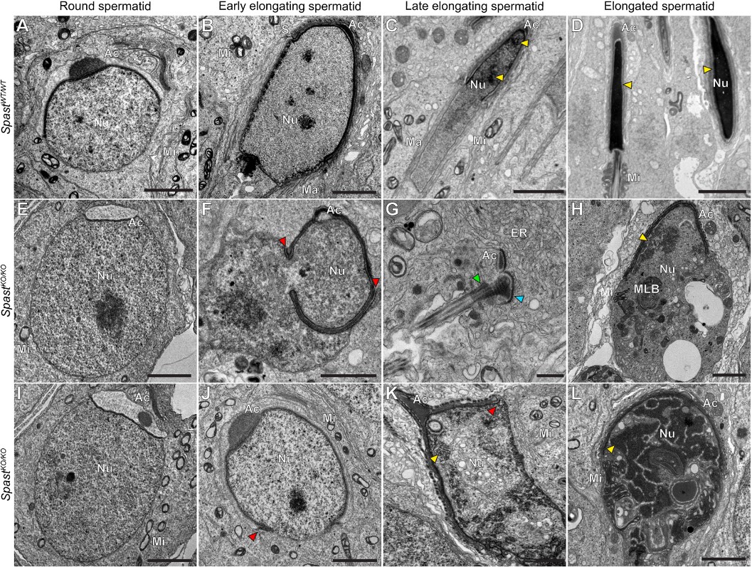 FocalPlane (@focalplane_jcs) on Twitter photo It’s #EMmonday & we’re looking at the role of spastin in nuclear integrity during spermatid elongation. @samrcheers, @OBryanMoira <a href="/_jessdunleavy_/">Jessica Dunleavy</a> et al. find that spastin plays an essential role in the development & function of male gametes.
<a href="/Dev_journal/">Development</a>: journals.biologists.com/dev/article/15… It’s #EMmonday & we’re looking at the role of spastin in nuclear integrity during spermatid elongation. @samrcheers, @OBryanMoira <a href="/_jessdunleavy_/">Jessica Dunleavy</a> et al. find that spastin plays an essential role in the development & function of male gametes.
<a href="/Dev_journal/">Development</a>: journals.biologists.com/dev/article/15…