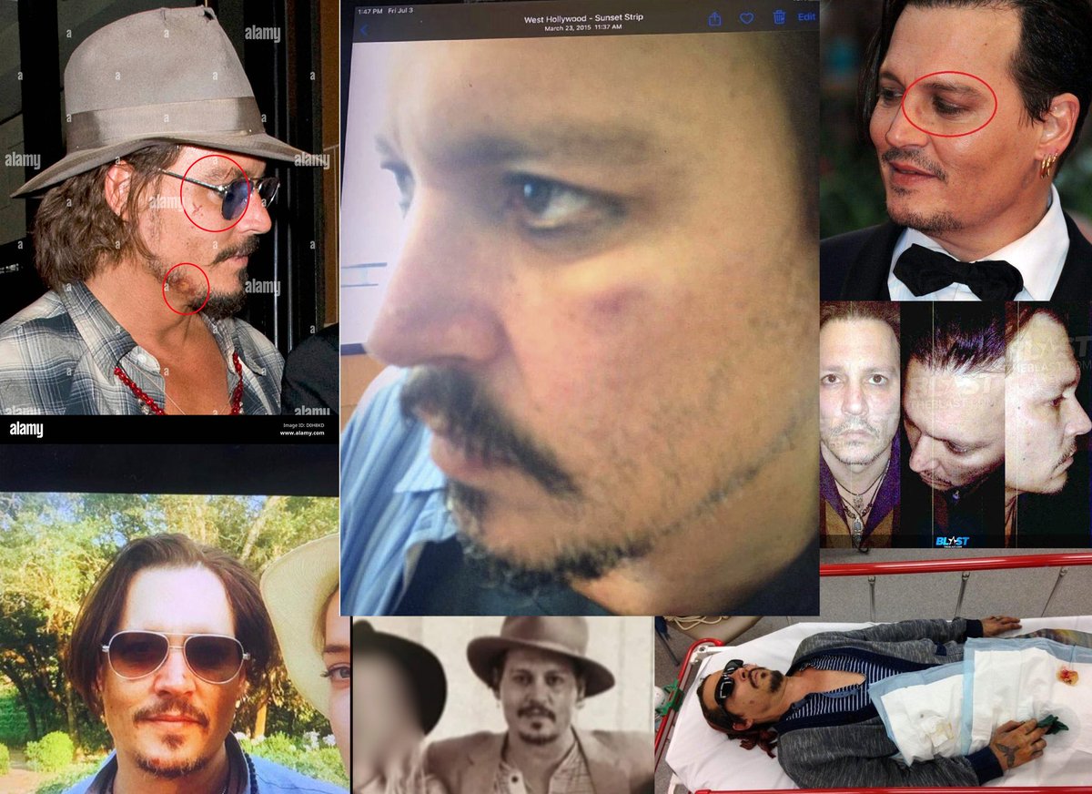 Vader_Resists's tweet photo. @Tldj1212 @WhenCried Real Survivors v. Heard, the alcoholic druggie abuser.
See if you can spot the differences.
#AmberHeardlsAnAbuser
#AmberHeardIsHumanGarbage
#AmberHeardDeservesPrison
#AllAmberHeardStansAreLiars
#JohnnyDeppDeservesAnApology
#JohnnyDeppIsASurvivor
#JohnnyDeppWon
#JohnnyDeppIsFree https://t.co/7hwMHAd0yS