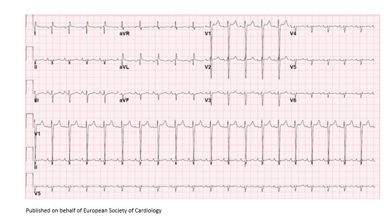 European Society of Cardiology Journals tweet media