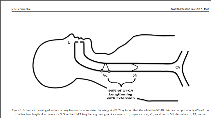 NaveenEipe's tweet photo. @Anaes_Reports Cephalad movement of the carinii during laparoscopic insufflation can also result in increased airway pressures due to endobronchial migration of the ETT?
#TheTrachealAccordion
#ClassicPaper
From HerwayST & BenumofJL
https://t.co/UWIKNF9679
@AirwayMxAcademy https://t.co/6NqWKifKnx
