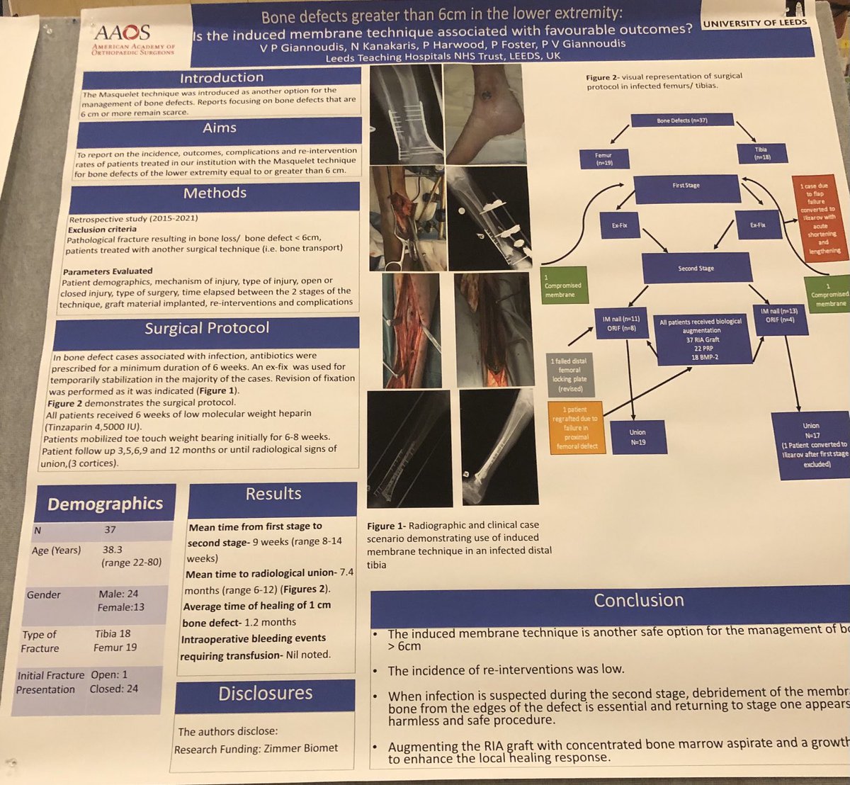 Trial from Dr Giannoudis showing effectiveness of Masquelet in infected bone loss, provided you go back to stage 1 if still suspect infection during the second stage. I’ve treated things this way also and have had good success.
