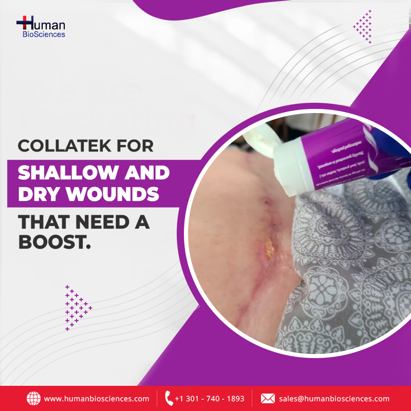 #Collatek collagen #wound gel is easy to apply. 
Get your medical-grade #collagen at home contact at info@humanbiosciences.com.
humanbiosciences.com/collagen-colla…

#hbs #HumanBioSciences #woundcare #woundclinic #woundhealing #healfaster #allwoundsmatter #woundtreatment #collagengel #USA