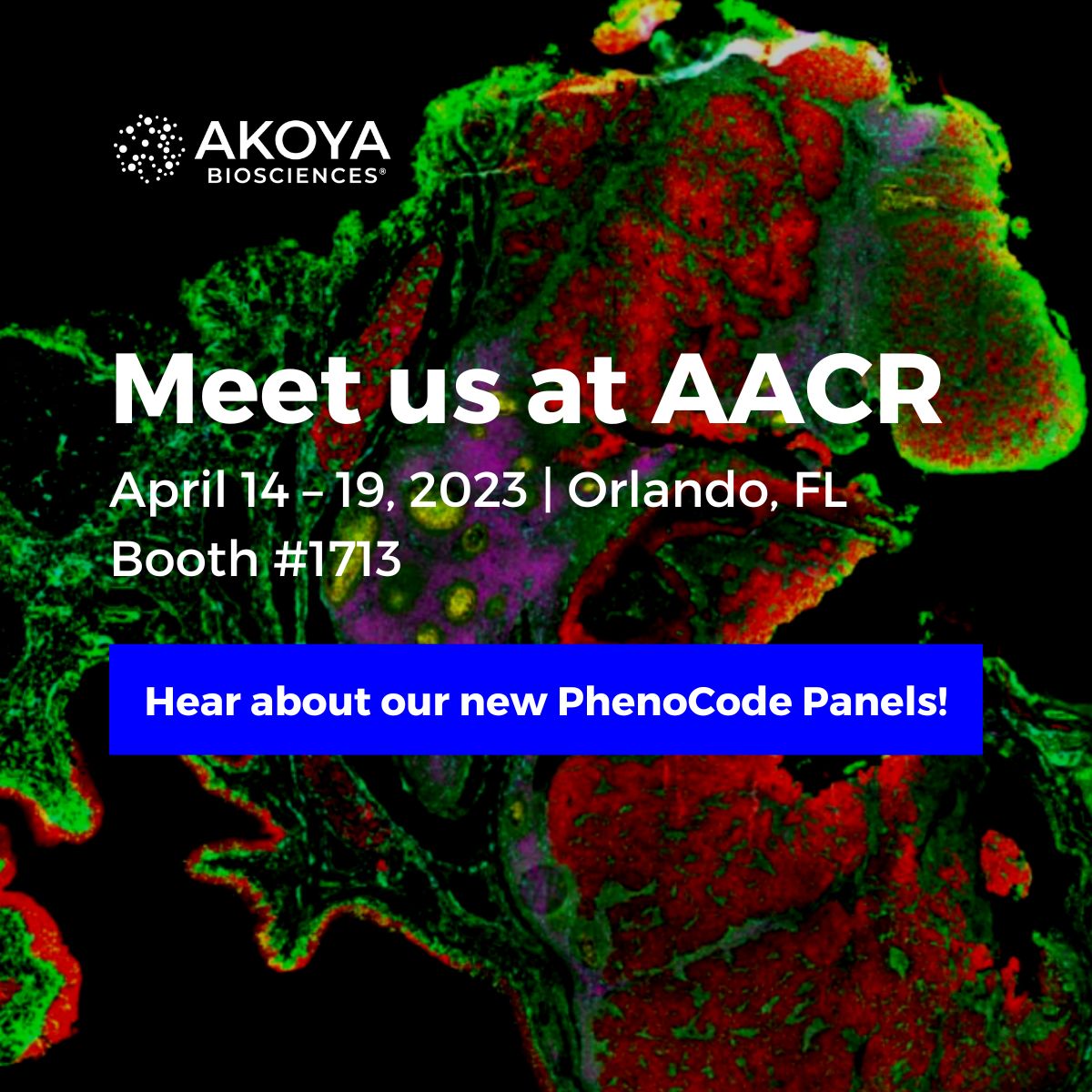 AkoyaBio's tweet photo. ✈️ Traveling to #AACR23? We’re excited to introduce a novel family of #PhenoCode™ Panels that simplify the workflow to study hundreds of #biomarker targets, including protein and #RNA, across multiple sample types.
Learn more: https://t.co/G5NX7Zgi0T
#spatialbiology @AACR https://t.co/vUfk8RjEFU
