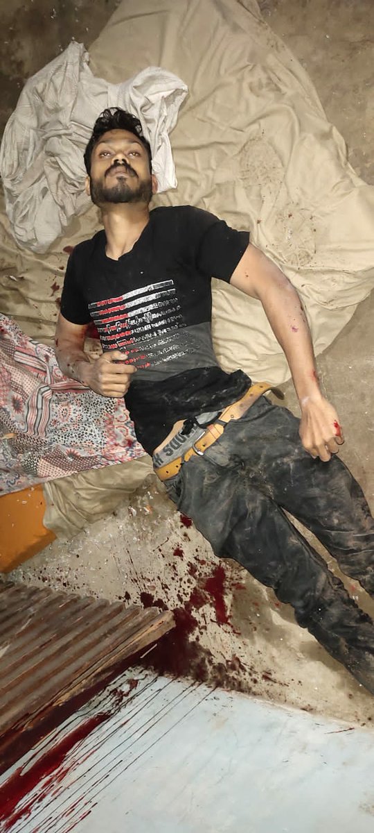 3friendlights's tweet photo. [Graphic content]

This is Karachi... Jaha admi ki jan ki keemat bhale wo shareef ho ya koi dako bina kisi reham k Mar diya jata hn... https://t.co/lNYURVrpsd