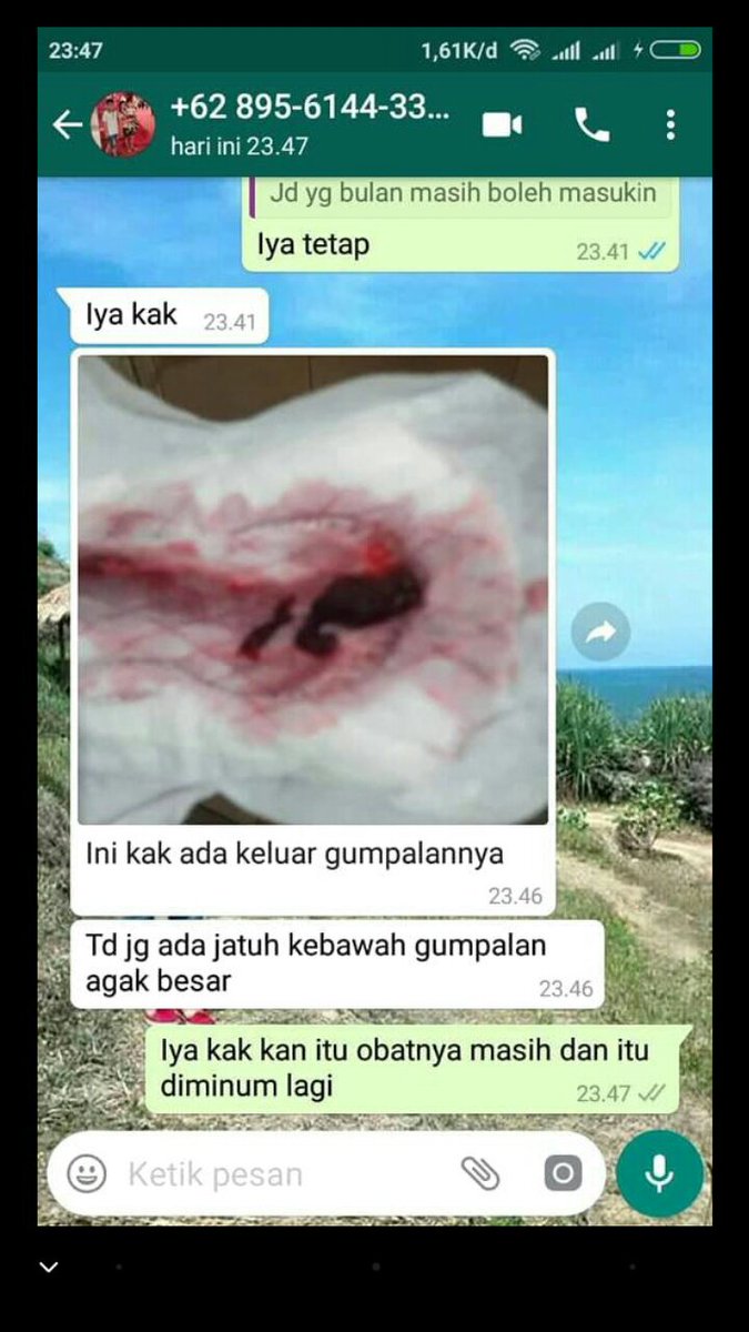 Kamasutra992's tweet photo. OBAT ABORSI !!
OBAT TELAT BULAN !!
OBAT PENGGUGUR KANDUNGAN. PALING AMPUH DAN CEPAT TUNTAS!!!
MINAT ORDER WA 0812-2662-1415 https://t.co/sFuFlghtYG