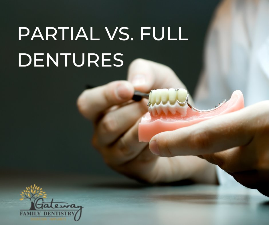 GFamDentistry's tweet photo. Dentures are prosthetics that resemble teeth and are constructed to replace missing ones. A dental expert is the best person to guide the patient regarding what kind of dentures would be best suited for them. 

Learn more about dentures: https://t.co/U1kUXyAQDP https://t.co/VBwU3qikt9