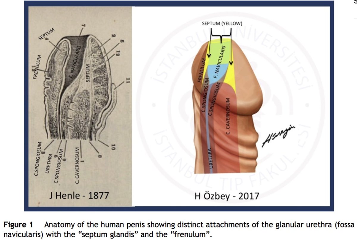 huseyinozbey13's tweet photo. Anatomy of the human penis #septumglandis #fossanavicularis #frenulum #hypospadias
@jpedsurg @jpurology
https://t.co/nVnLURZSFS https://t.co/wjVxm3Z9dj