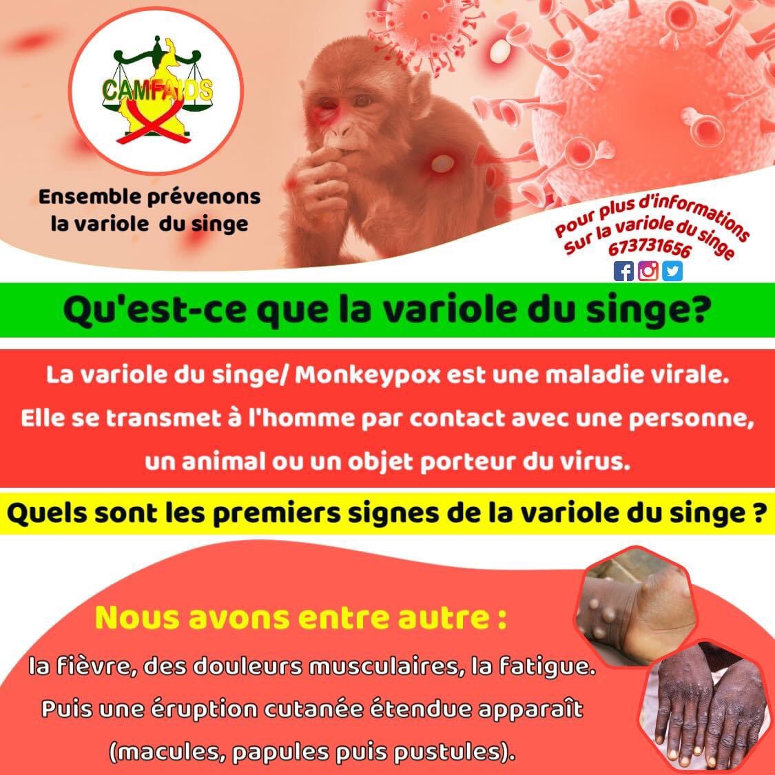 camfaidsCM's tweet photo. QU’EST-CE QUE LA VARIOLE DU SINGE ?

La variole du singe ou MONKEYPOX, est une maladie virale.

Elle se transmet à l’homme par contact avec une personne, un animal ou un objet porteur du virus.#varioledusinge #OMS https://t.co/c1EUz2Jhke