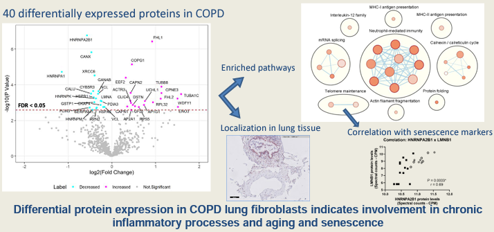 #ResearchArticle A proteomics approach to identify COPD-related changes in lung fibroblasts by Nicolas J. Bekker et. al (@campusgr_):

ow.ly/k1bT50Nxofq

#COPD #Lung #Proteomics @PHorvatovich @OmicsNL