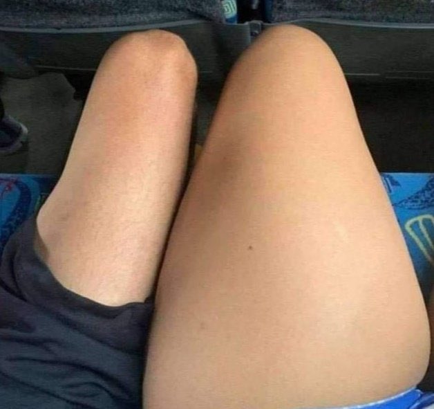 la pierna de cualquier persona de mi circulo // mi pierna