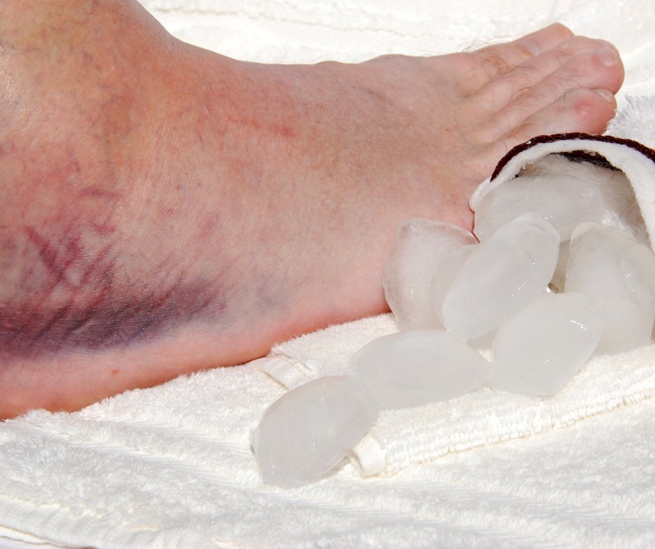 CliftonFoot's tweet photo. Spring is sports season for many athletes and weekend warriors. It's also ankle sprain season for Dr. Kenneth Wilhelm at Clifton Foot and Ankle Center. Learn more about your treatment options and call us if you sprain your ankle: https://t.co/Lw50mxIKJu https://t.co/DfYj2szuhS