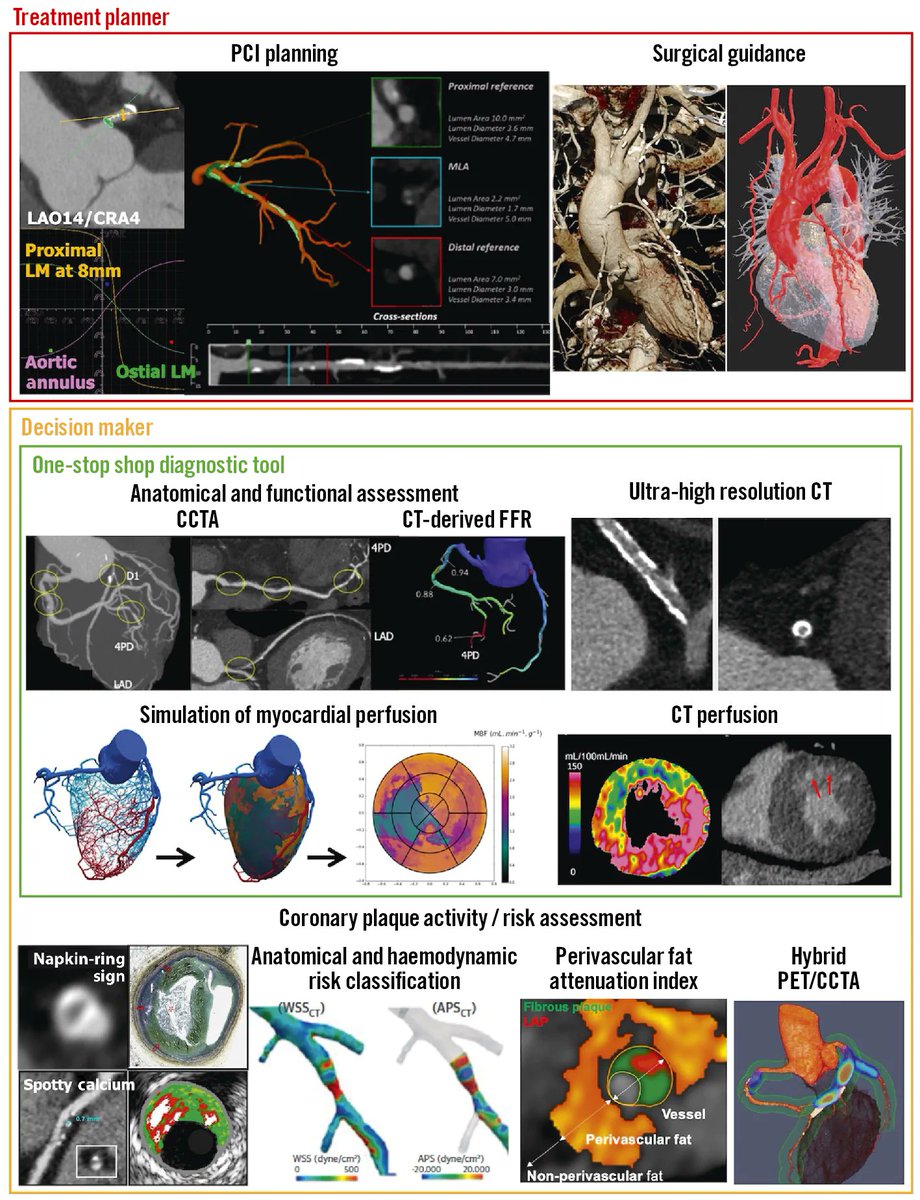 Times are changing. In this issue of Eurointervention, a State-of-the-Art review on coronary computed tomographic angiography as a first-line investigation in the diagnosis and decision-making for coronary artery disease. eurointervention.pcronline.com/article/comput…
