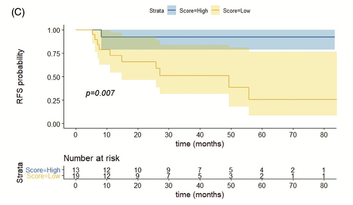 GustavoVillold4's tweet photo. Is Th2-score a accurate predictive biomarker of response to #BCG in patients with #HRNMIBC?
Thx @MDAndersonNews @UroDocAsh Dr SupriyaNagaraju and all @IAF_Fleming members.  @urotoday @OncoAlert @ResidentesCAU @Blatam_urology @IBCG_BladderCA @IBCN1997 @marigfern @fundacion_FUCA https://t.co/tg823b94x4