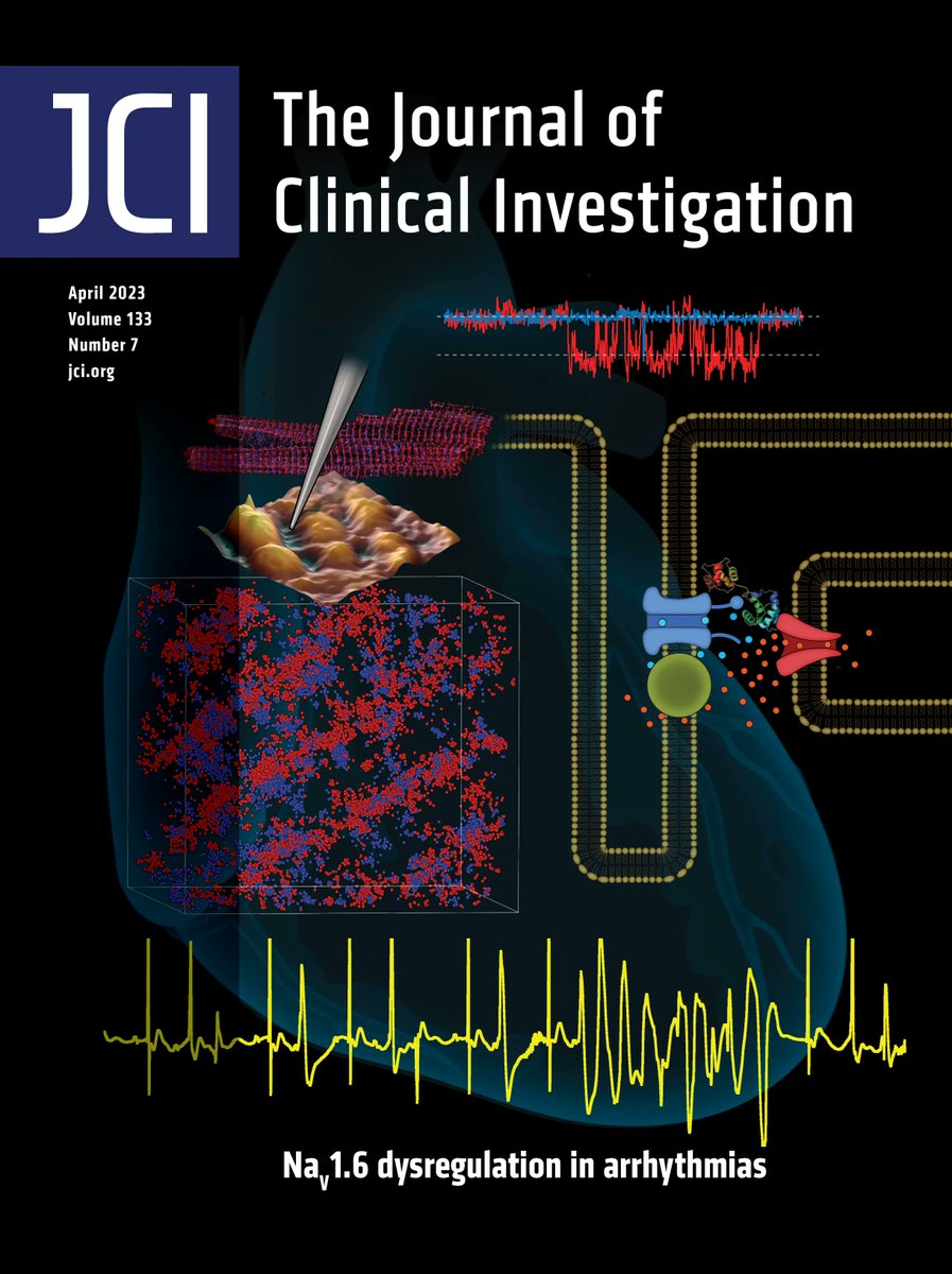 jclinicalinvest's tweet photo. #Cover: Long QT-associated calmodulin mutation promotes arrhythmias via NaV1.6 within T-tubules: https://t.co/FLbm3ByS8m 
Image: rendered heart &amp; T-tubule structure overlaid by single channel NaV traces; T-tubules &amp; an ECG featuring an arrhythmia (yellow).
@OSUWexMed 
#Cardiology https://t.co/kx26tsJb67