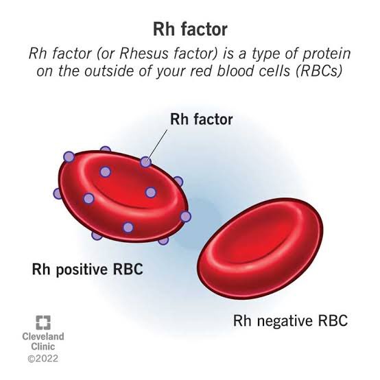 follforfight's tweet photo. ในส่วนRBC (red blood cell) 
คนนี้กรุ๊ป B รับได้จาก O กับ B
แต่คนนี้ต้องรับ Rh neg เท่านั้นนะ เพราะเคยได้เลือด Rh+ มา ตอนนี้ร่างกายเค้ามี Rh antibody ละ 
ตอบ ไม่ 1 ก็ 3 

ส่วน Plasma ก็ให้ AB เพราะไม่มี antibody ใน Plasma(ให้Oไม่ได้)
ดังนั้นตอบ 1

(FFP คือ fresh frozen plasma ) https://t.co/FWkbvYDRNc