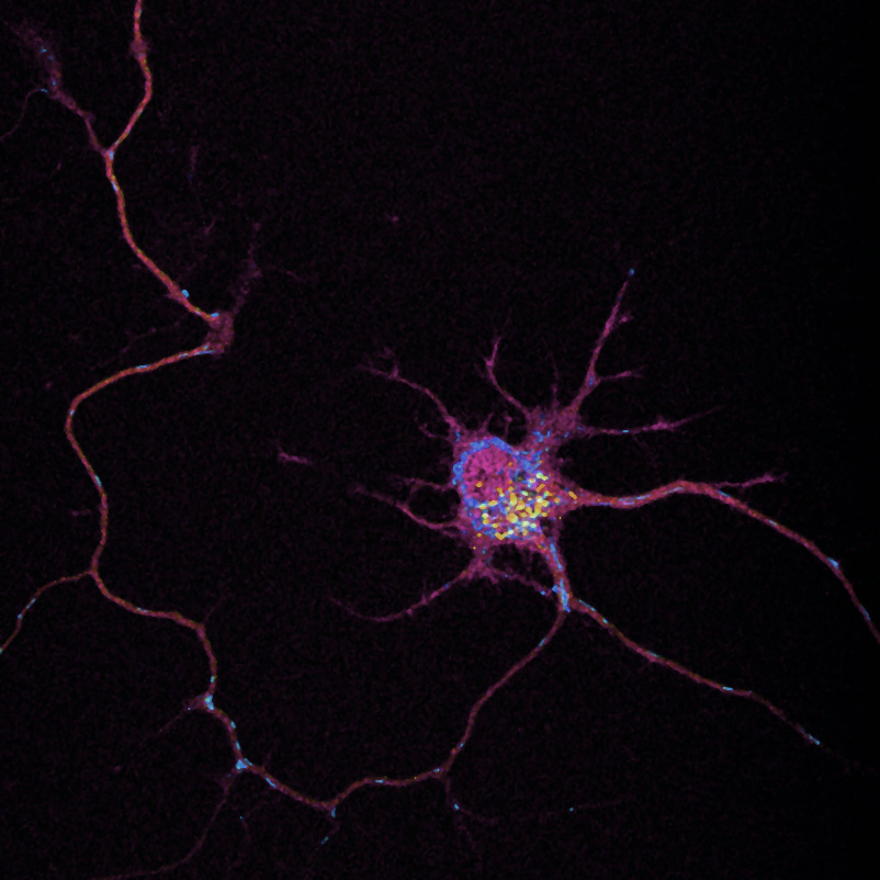 Hugo Chrost (@chrost_hugo) on Twitter photo Cortical neuron with its mitochondria and autophagic vesicles.
Credit: <a href="/BrandonMeyerink/">Brandon Meyerink</a>
#neuroscience Cortical neuron with its mitochondria and autophagic vesicles.
Credit: <a href="/BrandonMeyerink/">Brandon Meyerink</a>
#neuroscience