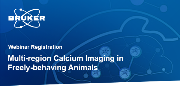 Neurescence (Acquired by Bruker) tweet media